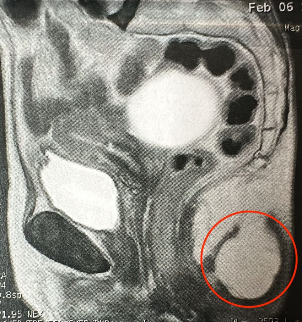 Figure 2 du Procto Quiz d'août 2026